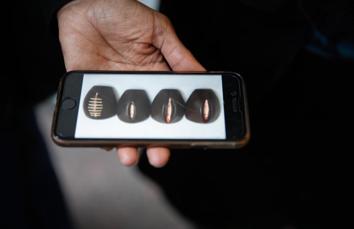 En bild visas på en iPhone på modeller av de fyra olika typerna av kvinnlig könsstympning.